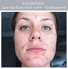 Профессиональная косметика для проблемной кожи лица: основные требования.