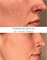 PUMPKIN RESURFACER SKINCOUTURE | Тыквенный пилинг для кожи лица
