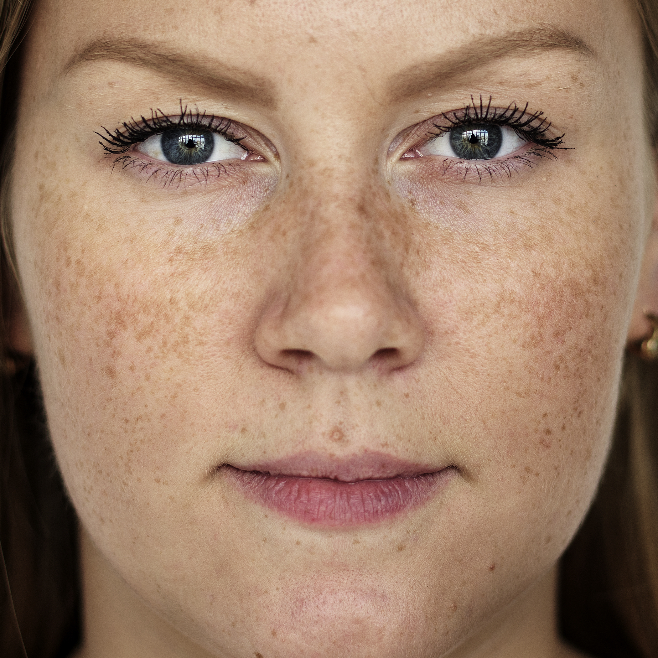 Причины появления пигментных пятен на лице: основные факторы и способы их устранения