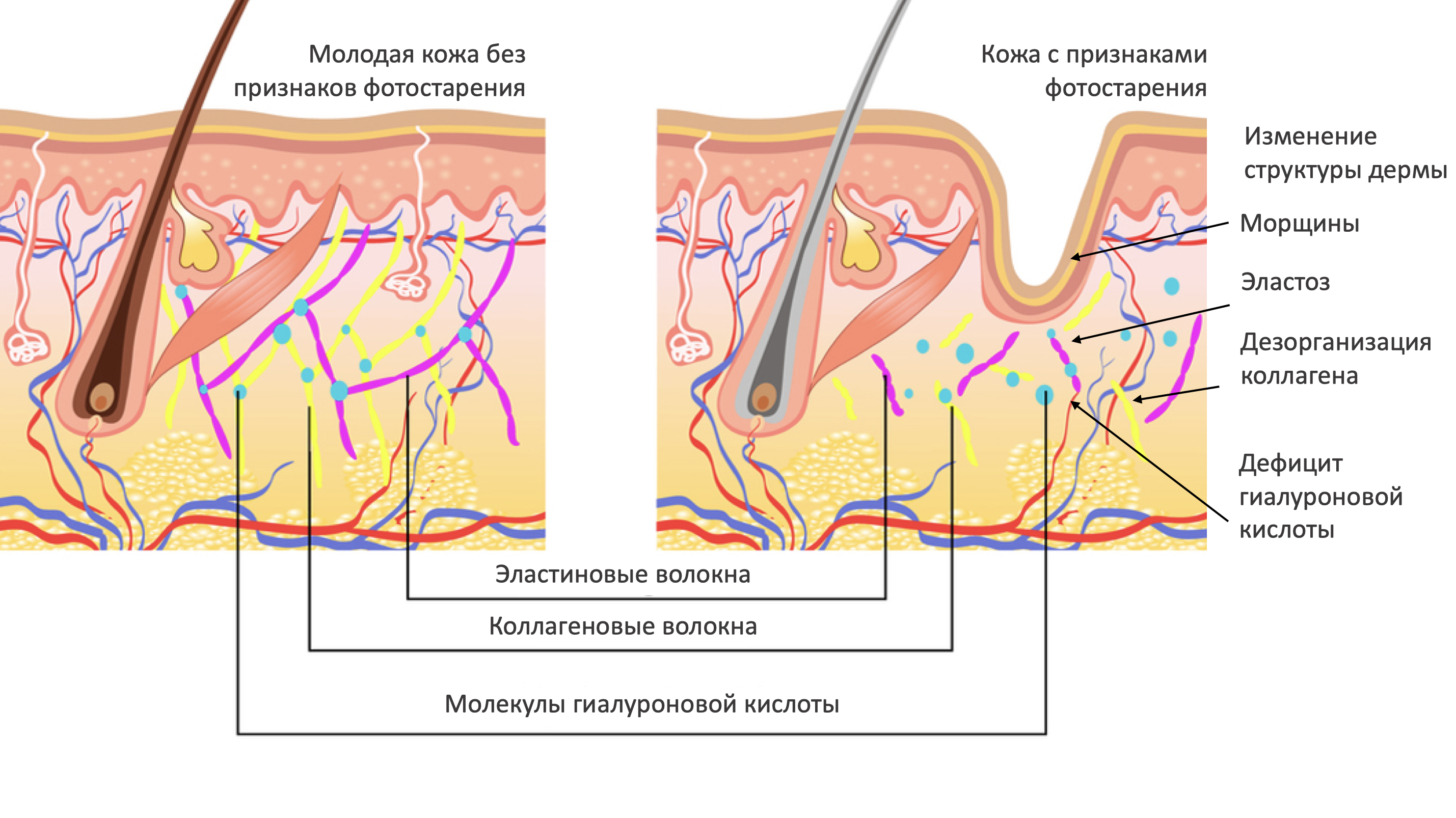 Картинка коллаген и эластин